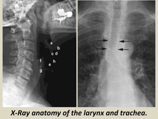 X-Ray anatomy of the larynx and trachea. 
 