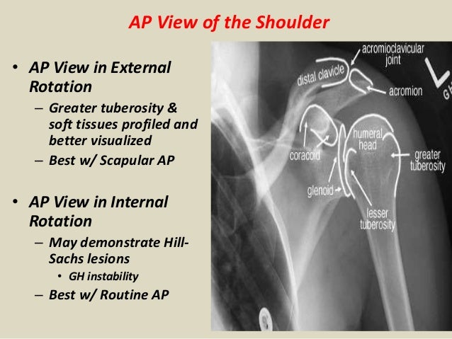 Presentation1.pptx, radiological anatomy of the upper limb joint.