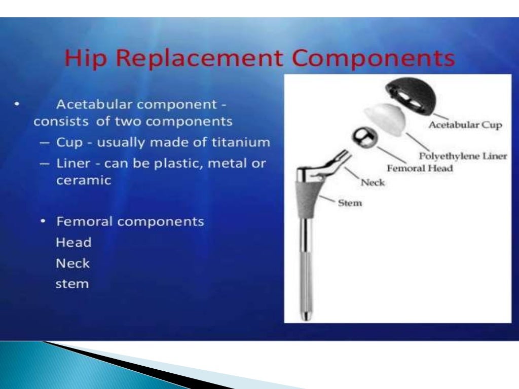 ANESTHETIC MANAGEMENT OF TOTAL HIP REPLACEMENT SURGERY