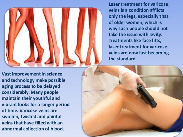 What is a venous insufficiency treatment?