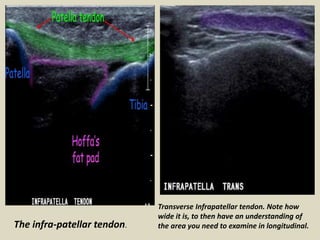 Presentation1.pptx, radiological anatomy of the lower limb anatomy. | PPTX