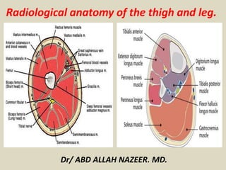 Radiological anatomy of the thigh and leg. 
Dr/ ABD ALLAH NAZEER. MD. 
 