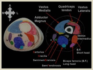 Muscles Of The Thigh Anterior Medial Posterior 50 Off Muscles Of The Thigh Anterior Medial Posterior 50 Off