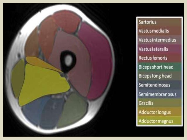 Presentation1 Pptx Radiological Anatomy Of The Thigh And Leg