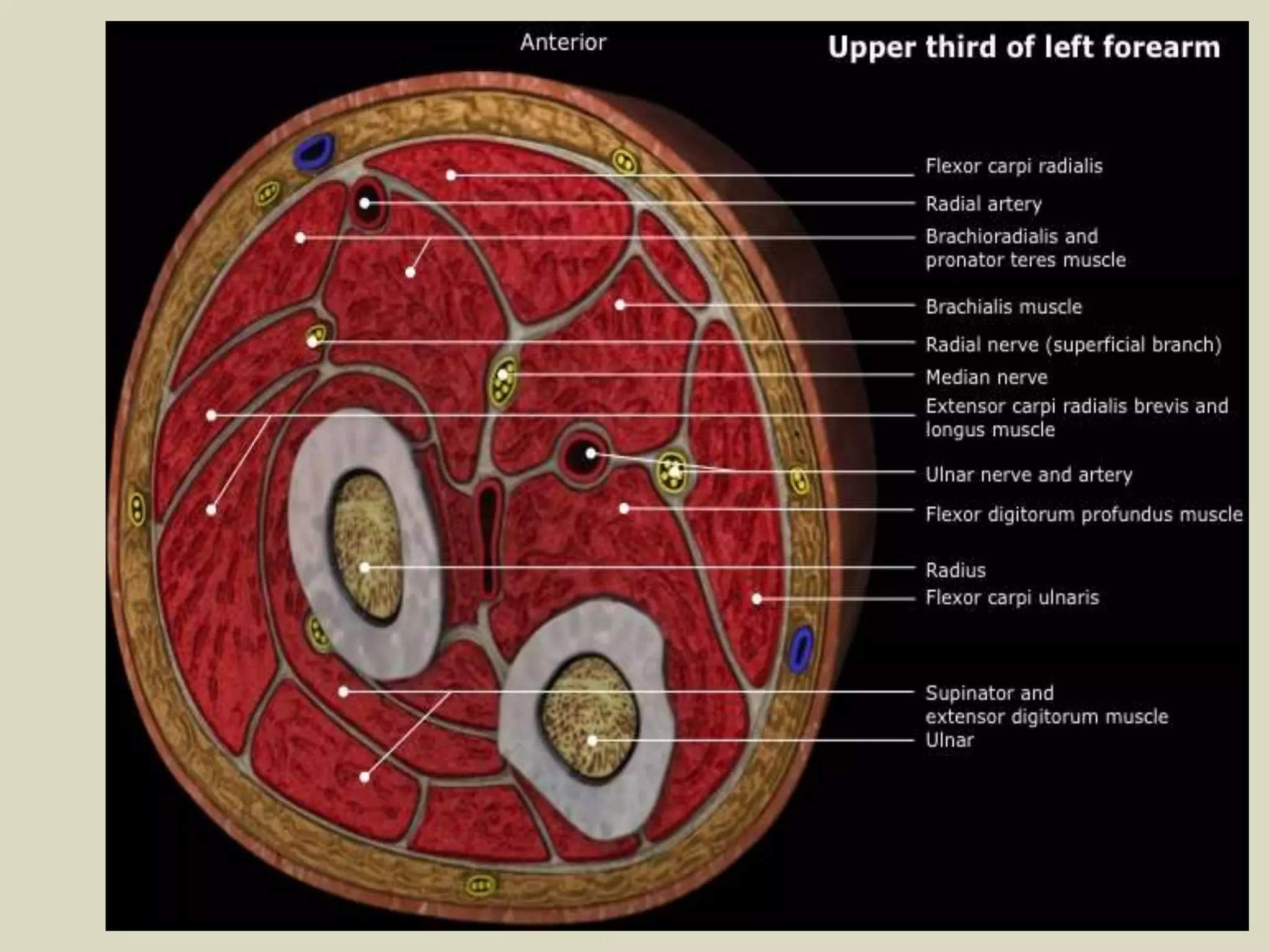 Presentation1.pptx, radiological anatomy of the arm and forearm. | PPTX