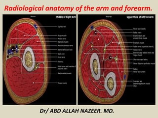 Radiological anatomy of the arm and forearm. 
Dr/ ABD ALLAH NAZEER. MD. 
 