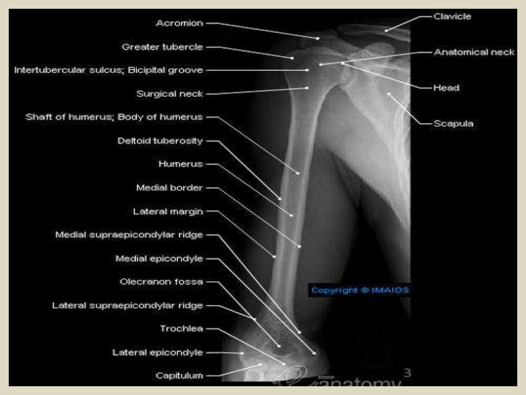Presentation1.pptx, radiological anatomy of the arm and forearm.