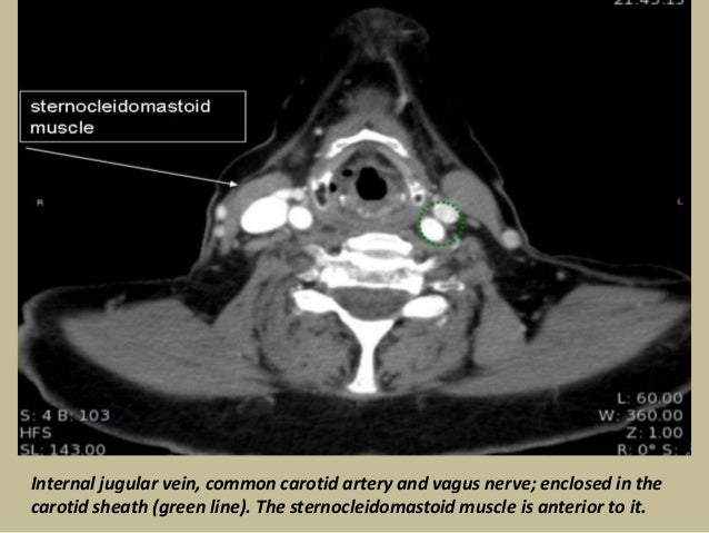 Presentation1 Pptx Radiological Vascular Anatomy Of The