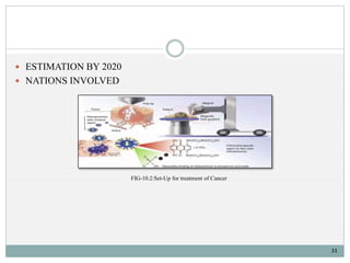 11 
 ESTIMATION BY 2020 
 NATIONS INVOLVED 
FIG-10.2:Set-Up for treatment of Cancer 
 