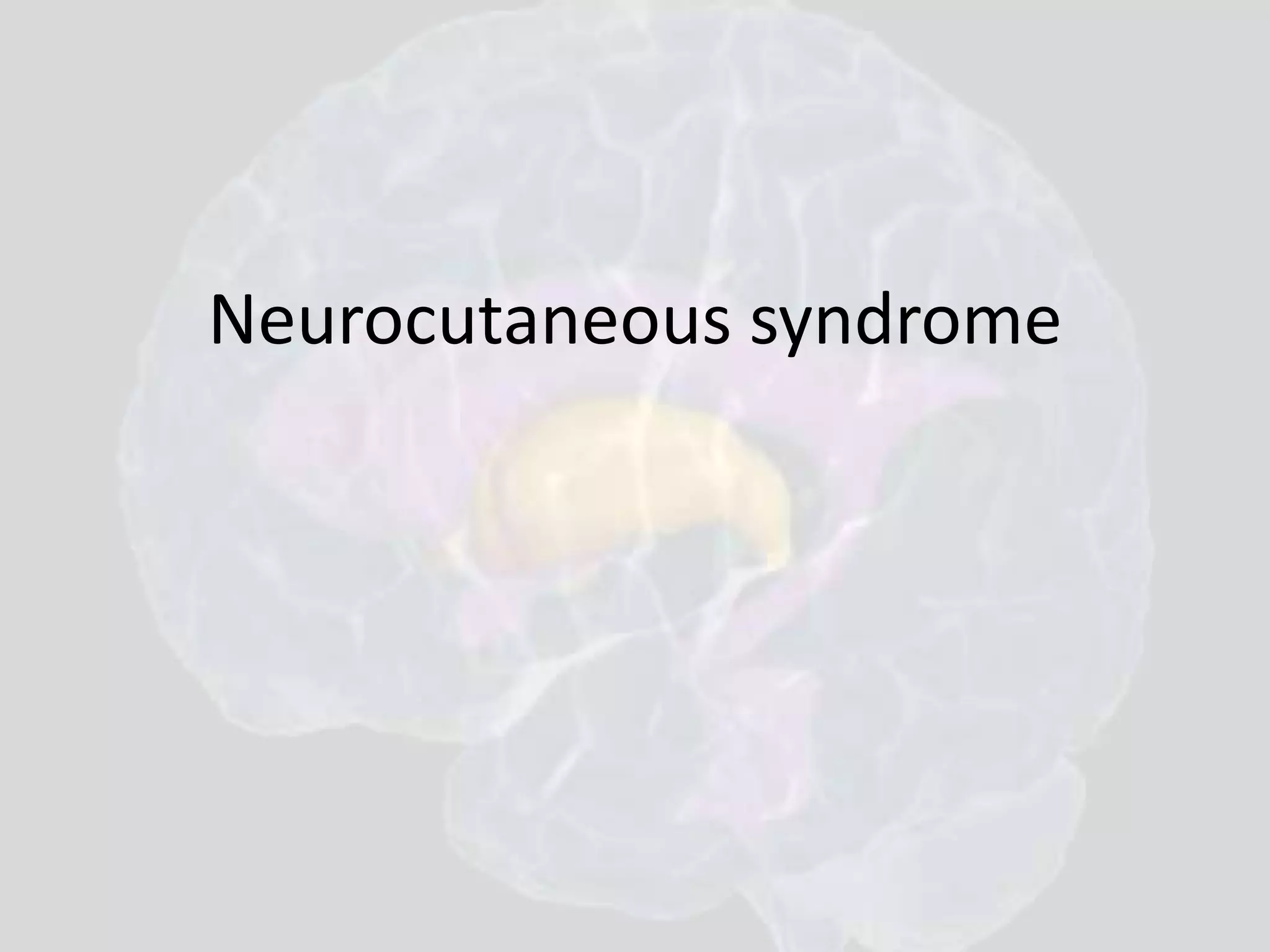 Neurocutaneous syndrome 
 