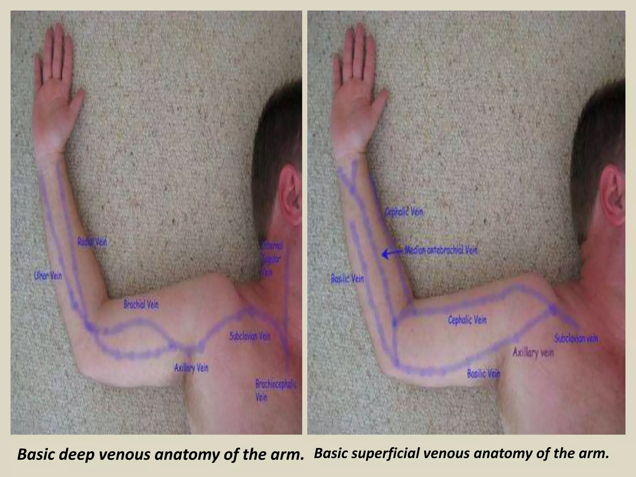 Presentation1.pptx, radiological vascular anatomy of the upper and ...