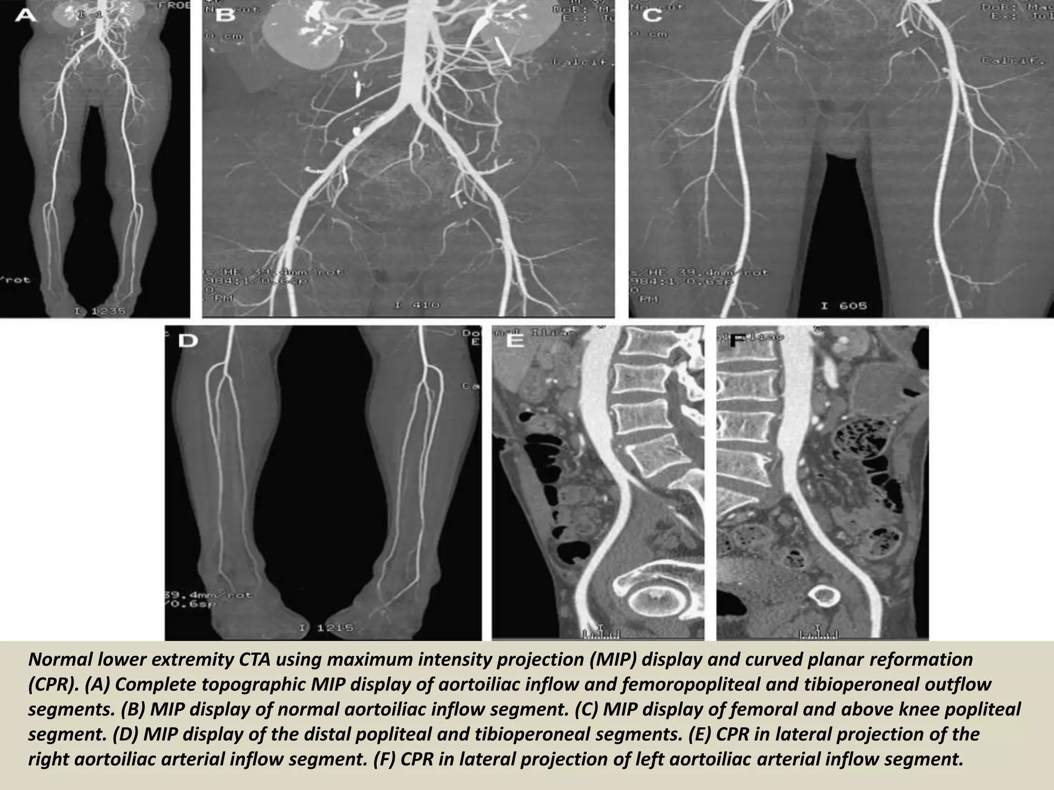 Presentation1.pptx, radiological vascular anatomy of the upper and ...