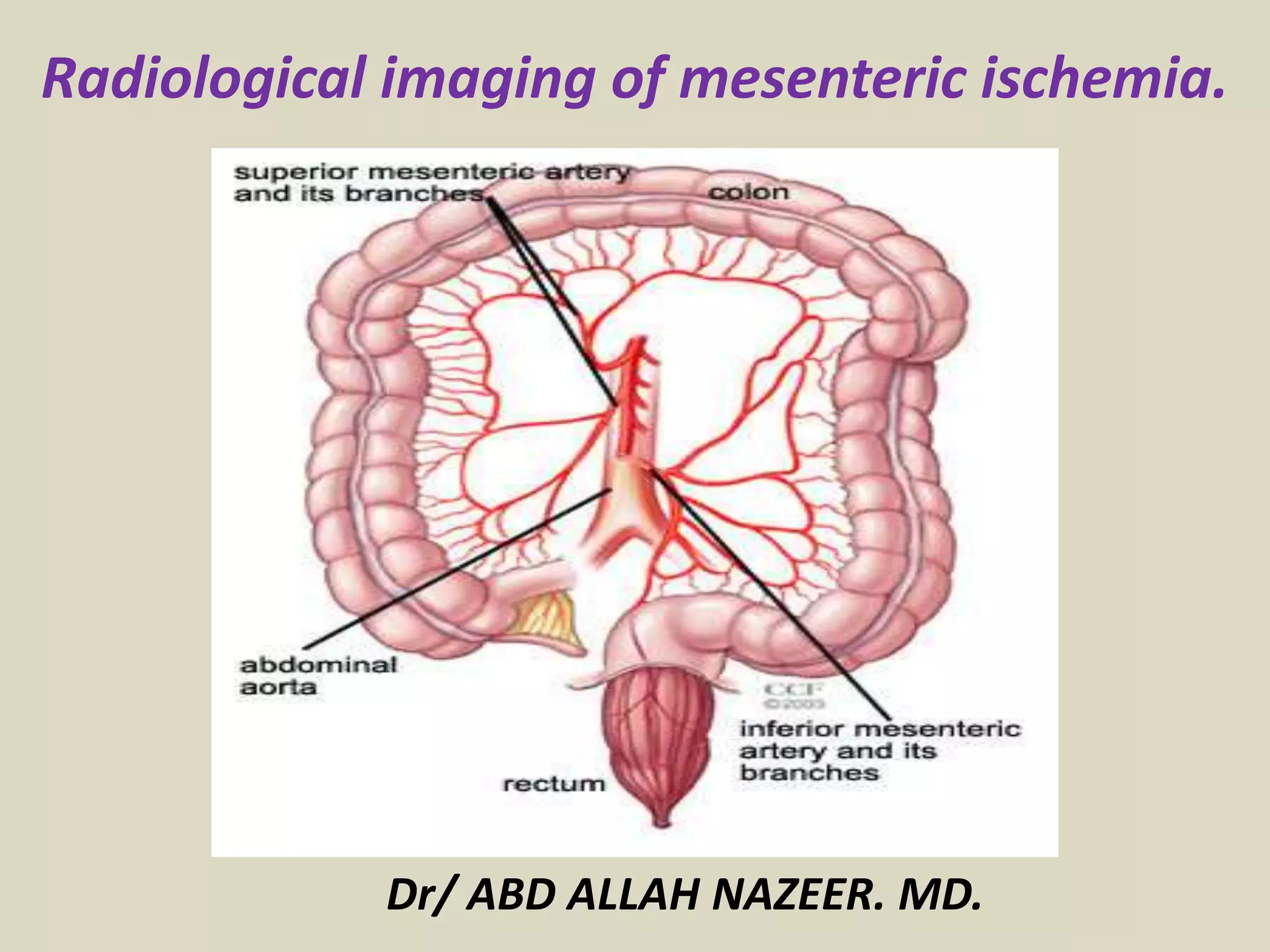 Mesenteric Infarction Radiopaedia Presentation1.pptx, radiological imaging of mesenteric ischemia. | PPTX