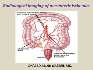 Radiological imaging of mesenteric ischemia.
Dr/ ABD ALLAH NAZEER. MD.
 