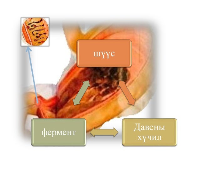 хоол боловсруулах замын эмгэг ба эмийн зохистой хэрэглээ