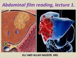Abdominal film reading, lecture 1.
Dr/ ABD ALLAH NAZEER. MD.
 