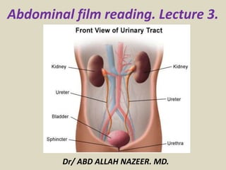 Abdominal film reading. Lecture 3.
Dr/ ABD ALLAH NAZEER. MD.
 