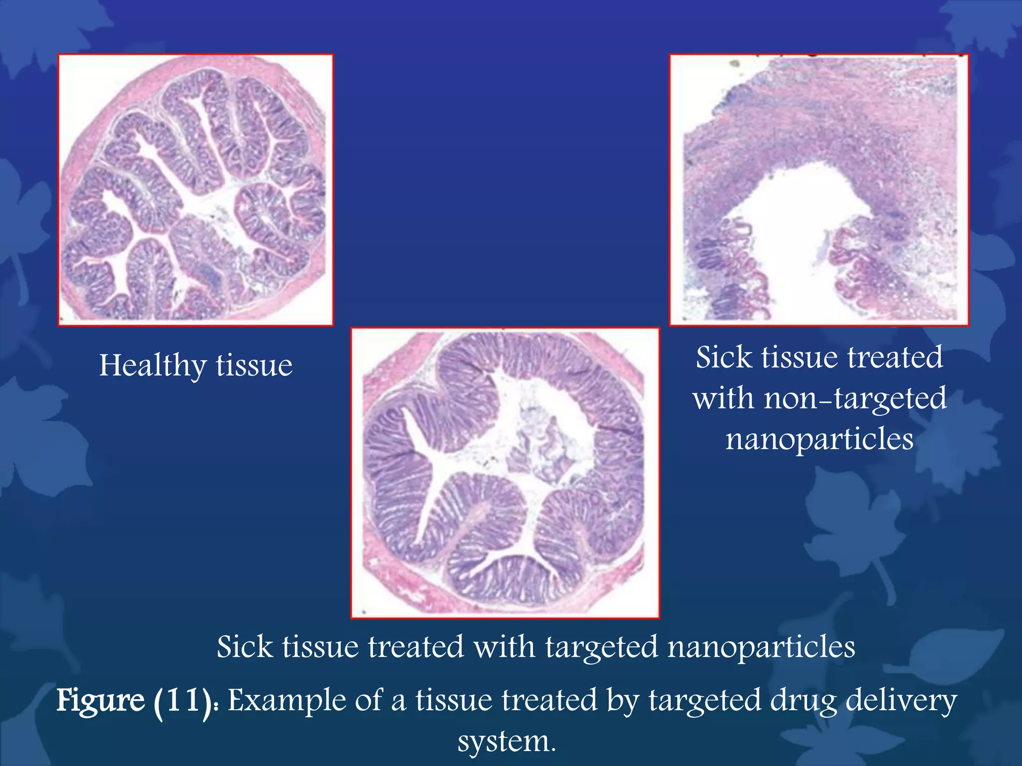 Healthy tissue Sick tissue treated
with non-targeted
nanoparticles
Sick tissue treated with targeted nanoparticles
Figure (11): Example of a tissue treated by targeted drug delivery
system.
 