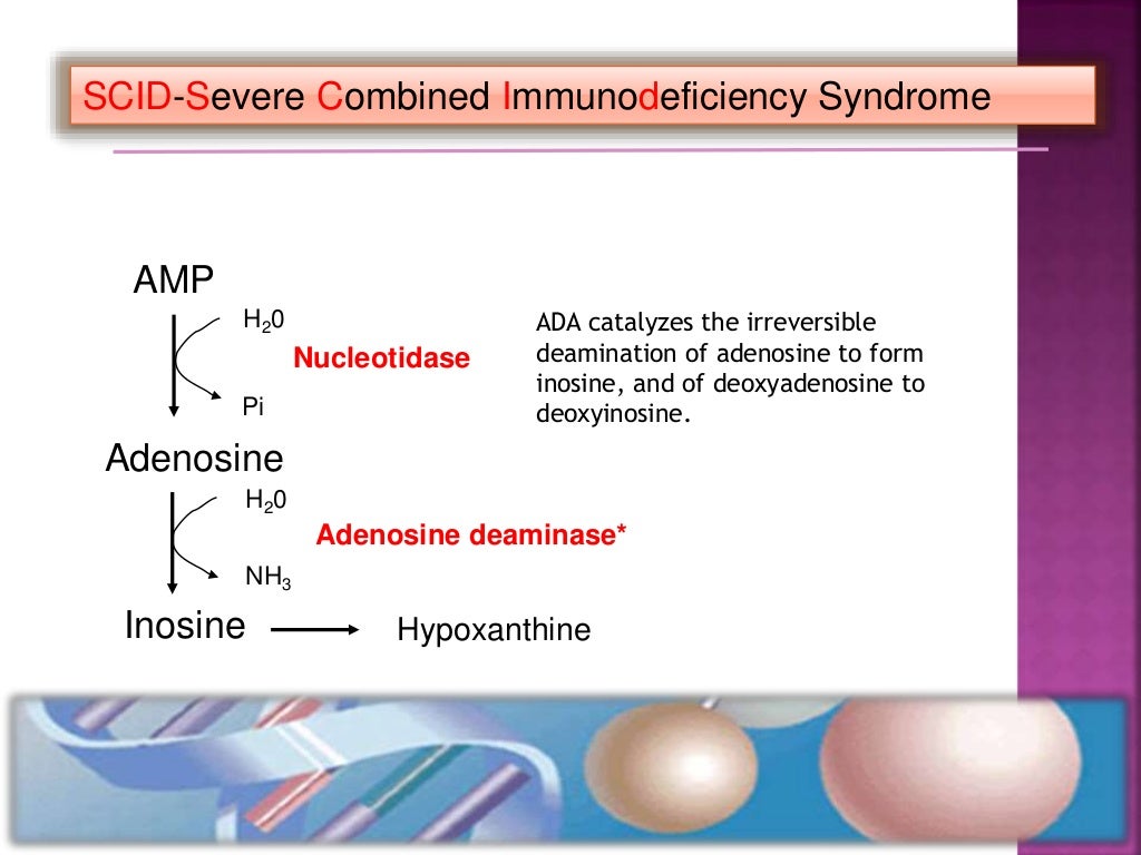 adenosine deaminase scid adenosine deaminase scid