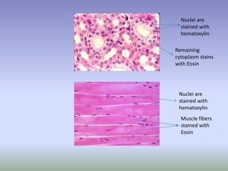 Nuclei are
stained with
hematoxylin
Remaining
cytoplasm stains
with Eosin
Nuclei are
stained with
hematoxylin
Muscle fibers
stained with
Eosin
 