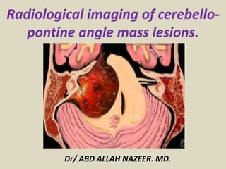Dr/ ABD ALLAH NAZEER. MD.
Radiological imaging of cerebello-
pontine angle mass lesions.
 