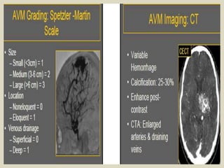 Presentation1.pptx, radiological imaging of brain av malformation. | PPTX