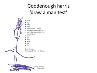 Goodenough harris
‘draw a man test’
 