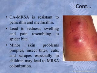 Cont…
• CA-MRSA is resistant to
penicillin and methicillin.
• Lead to redness, swelling
and pain resembling to
spider bite.
• Minor skin problems
pimples, insect bites, cuts,
and scrapes especially in
children may lead to MRSA
colonization.
 
