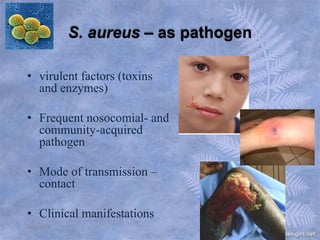 MRSA | PPTX