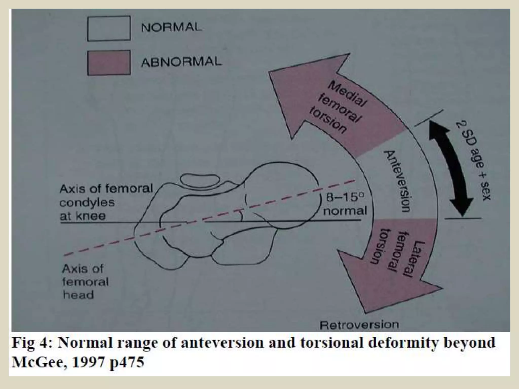 Presentation1.pptx, radiological imaging of anteversion angle. | PPTX