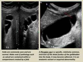 Presentation1.pptx, ultrasound examination of the liver and gall ...