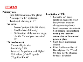 Primary role
• Size determination of the gland
• Assess pelvic LN metastasis
• Treatment planning in RT
Features:
• Loss of periprostatic fat planes
• Bladder base deformity
• Obliteration of the normal angle
b/w the SV and post. aspect of
UB
LN involvement
Abnormality in size
Sensitivity 25%
Reserved for patients with higher
PSA values (>20-25 ng/ml)
CT guided FNAC
Limitation of CT:
• Lacks the soft tissue
resolution needed to detect
intraprostatic anatomic
changes due to primary
tumor , capsular extension or
SVI because the neoplasm
usually has the same
attenuation as the normal
prostate gland
• Can't detect microscopic
disease
• False Positive- Artifact of
Bx and plane b/w SV and
UB base may be obscured
by rectal distension
CT SCAN
 