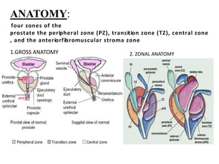 ANATOMY:
four zones of the
prostate the peripheral zone (PZ), transition zone (TZ), central zone
, and the anteriorfibromuscular stroma zone
1.GROSS ANATOMY
BASE
APEX
2. ZONAL ANATOMY
 
