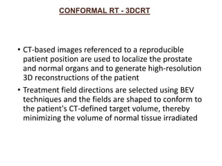 CONFORMAL RT - 3DCRT
• CT-based images referenced to a reproducible
patient position are used to localize the prostate
and normal organs and to generate high-resolution
3D reconstructions of the patient
• Treatment field directions are selected using BEV
techniques and the fields are shaped to conform to
the patient's CT-defined target volume, thereby
minimizing the volume of normal tissue irradiated
 