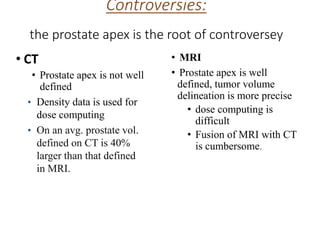 Controversies:
the prostate apex is the root of controversey
• CT
• Prostate apex is not well
defined
• Density data is used for
dose computing
• On an avg. prostate vol.
defined on CT is 40%
larger than that defined
in MRI.is not well defined
• MRI
• Prostate apex is well
defined, tumor volume
delineation is more precise
• dose computing is
difficult
• Fusion of MRI with CT
is cumbersome.
 