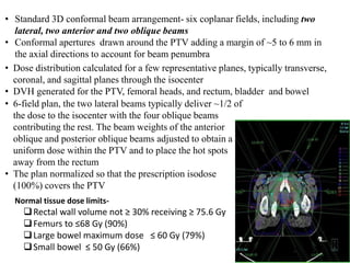 • Standard 3D conformal beam arrangement- six coplanar fields, including two
lateral, two anterior and two oblique beams
• Conformal apertures drawn around the PTV adding a margin of ~5 to 6 mm in
the axial directions to account for beam penumbra
• Dose distribution calculated for a few representative planes, typically transverse,
coronal, and sagittal planes through the isocenter
• DVH generated for the PTV, femoral heads, and rectum, bladder and bowel
• 6-field plan, the two lateral beams typically deliver ~1/2 of
the dose to the isocenter with the four oblique beams
contributing the rest. The beam weights of the anterior
oblique and posterior oblique beams adjusted to obtain a
uniform dose within the PTV and to place the hot spots
away from the rectum
• The plan normalized so that the prescription isodose
(100%) covers the PTV
Normal tissue dose limits-
Rectal wall volume not ≥ 30% receiving ≥ 75.6 Gy
Femurs to ≤68 Gy (90%)
Large bowel maximum dose ≤ 60 Gy (79%)
Small bowel ≤ 50 Gy (66%)
 