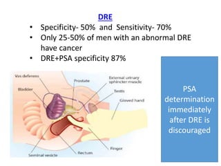 DRE
• Specificity- 50% and Sensitivity- 70%
• Only 25-50% of men with an abnormal DRE
have cancer
• DRE+PSA specificity 87%
PSA
determination
immediately
after DRE is
discouraged
 