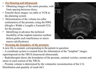 • Pre Planning and Ultrasound:
• Obtaining images of the entire prostate, with
5mm spacing between slices;
• Transfer these images via cable or VCR to
the planning system
• Determination of the volume (in cubic
centimeters) of the prostate, using the HWL
(Height x Width x Length) x Factor(0.523)
for the prostate;
• Identifying in advance the technical
feasibility of the implant (anterior urethral
defects,pubic arch interference or micro
macro calcifications).
• Drawing the boundary of the prostate:
A new file is created, corresponding to the patient in question;
- A coordinate system is created from the information of the "template" images
superimposed on the TRUS (transrectal ultrasound);
- Radiotherapist draws the boundaries of the prostate, seminal vesicles, rectum and
ureter in each section of the TRUS;
- Prostate volume is determined by the volumetric reconstruction of the U.S.
Distribution and quantity of seeds mCi.
 