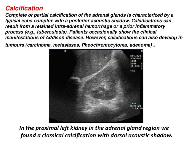 mass on kidney and adrenal gland