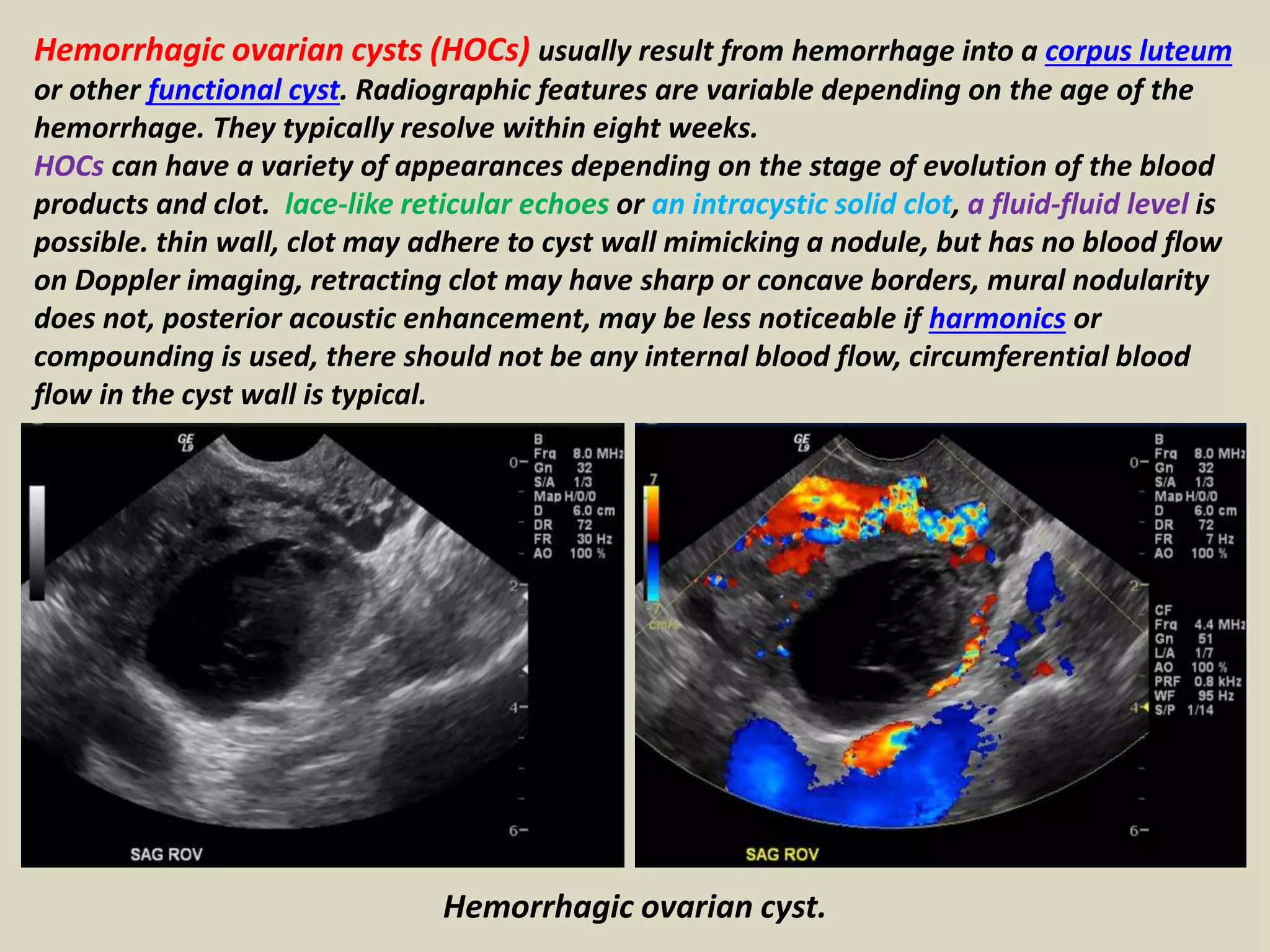 Presentation1.pptx, ultrasound examination of the uterus and ovaries ...