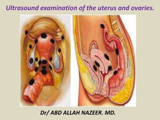Dr/ ABD ALLAH NAZEER. MD.
Ultrasound examination of the uterus and ovaries.
 