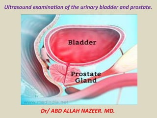 Ultrasound examination of the urinary bladder and prostate.
Dr/ ABD ALLAH NAZEER. MD.
 