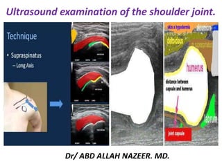 Ultrasound examination of the shoulder joint.
Dr/ ABD ALLAH NAZEER. MD.
 