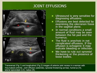Presentation1.pptx, ultrasound examination of the elbow joint.