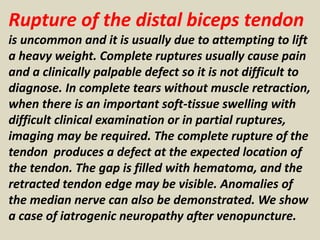 Rupture of the distal biceps tendon
is uncommon and it is usually due to attempting to lift
a heavy weight. Complete ruptures usually cause pain
and a clinically palpable defect so it is not difficult to
diagnose. In complete tears without muscle retraction,
when there is an important soft-tissue swelling with
difficult clinical examination or in partial ruptures,
imaging may be required. The complete rupture of the
tendon produces a defect at the expected location of
the tendon. The gap is filled with hematoma, and the
retracted tendon edge may be visible. Anomalies of
the median nerve can also be demonstrated. We show
a case of iatrogenic neuropathy after venopuncture.
 