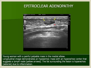 Presentation1.pptx, ultrasound examination of the elbow joint.