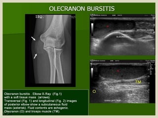 Presentation1.pptx, ultrasound examination of the elbow joint.