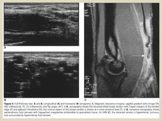 Presentation1.pptx, ultrasound examination of the elbow joint.
