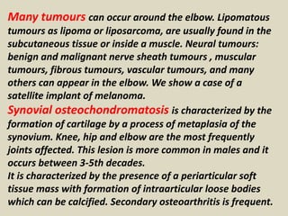 Many tumours can occur around the elbow. Lipomatous
tumours as lipoma or liposarcoma, are usually found in the
subcutaneous tissue or inside a muscle. Neural tumours:
benign and malignant nerve sheath tumours , muscular
tumours, fibrous tumours, vascular tumours, and many
others can appear in the elbow. We show a case of a
satellite implant of melanoma.
Synovial osteochondromatosis is characterized by the
formation of cartilage by a process of metaplasia of the
synovium. Knee, hip and elbow are the most frequently
joints affected. This lesion is more common in males and it
occurs between 3-5th decades.
It is characterized by the presence of a periarticular soft
tissue mass with formation of intraarticular loose bodies
which can be calcified. Secondary osteoarthritis is frequent.
 