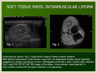 Presentation1.pptx, ultrasound examination of the elbow joint.